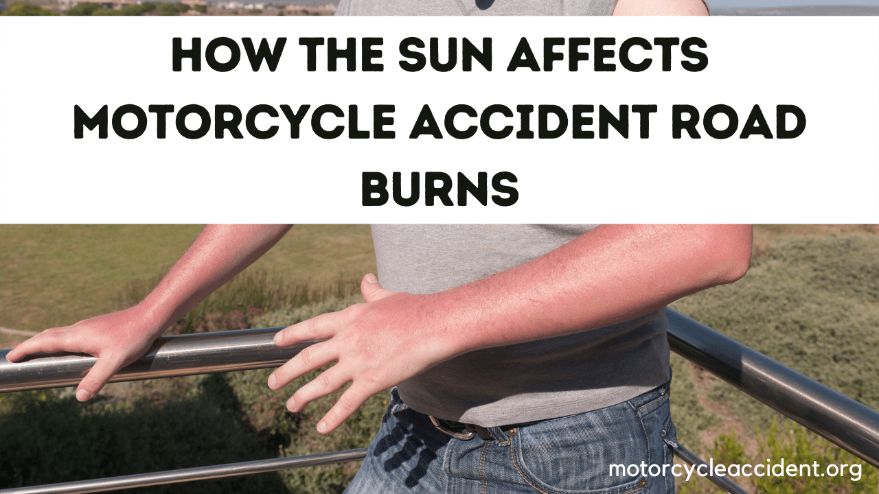 You are currently viewing How the sun affects motorcycle accident road burns